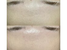 アンビジュ(un bijou)/フェイシャルWax