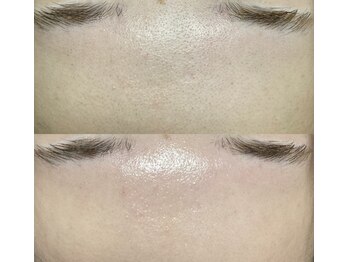 アンビジュ(un bijou)/フェイシャルWax