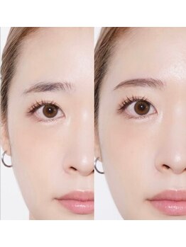 モアナ(MOANA)の写真/【眉悩み解消＋艶肌/毛穴改善】ハリウッドブロウリフト＋フェイスワックスでお顔の印象を明るくします◎