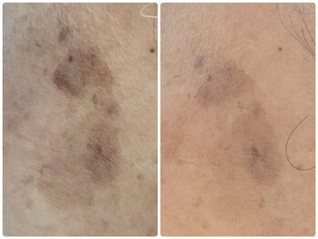 サラシック(salachic)/