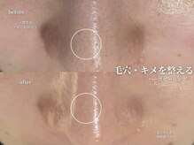 コウル 川西能勢口店(geoul)/毛穴レス美肌コース2回