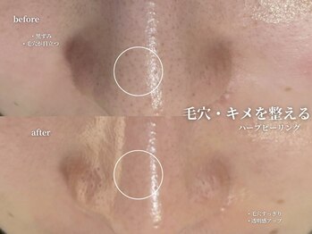 コウル 川西能勢口店(geoul)/毛穴レス美肌コース2回