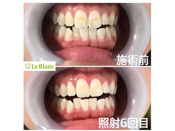ルブラン 奈良店(Le Blanc)/歯のチェックしていますか？