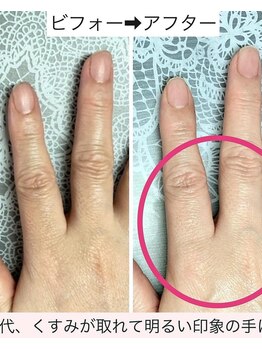 桃の木 吉祥寺店/手の潤いで印象が変わります