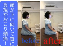 広島ミライエ整体院(広島MIRAIE整体院)/顔が下を向く事で首への負担が増