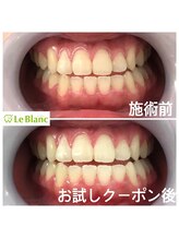 ルブラン 奈良店(Le Blanc)/男性も女性もモテ度アップ！