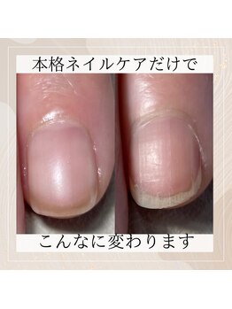 ビエル(BIeL)/京都 パラジェル フィルイン