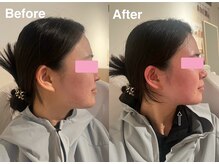 ヨサパーク インディゴ 都立大学(YOSA PARK Indigo)/デトックスコース×水素吸入