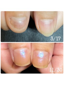 エヌ(N)/ネイリストMami限定