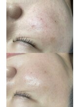 オリエンス(oriens)/