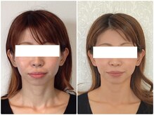 美容整体ウェリナ 名駅院/小顔矯正/骨盤矯正/美脚サロン