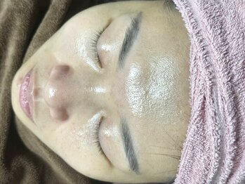 カメリア 新松戸(Camellia)の写真/【イチオシララピール♪】うる艶肌に♪水分チャージ可能なララピール＆イオン導入まで♪新松戸/ピーリング