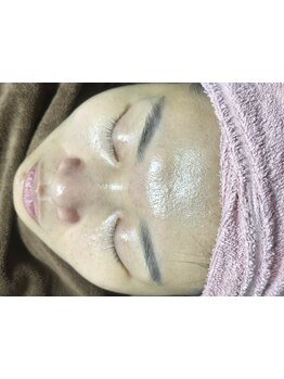 お肌をきれいにしたい