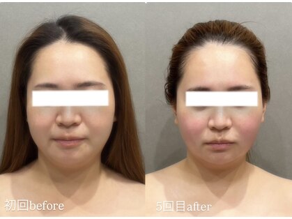 サラ(Sarah)の写真