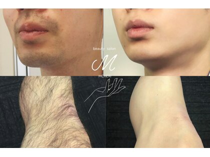 ミシェリ(MCHERI)の写真