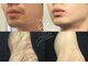 ミシェリ(MCHERI)の写真