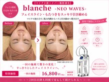 オリエンタルローザ 表参道(Oriental Rosa)/マイクロ波で小顔＆顎下すっきり