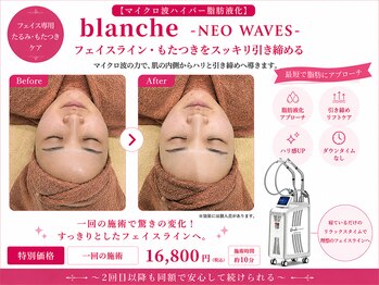 オリエンタルローザ 表参道(Oriental Rosa)/マイクロ波で小顔＆顎下すっきり