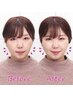 【顔の歪み&リフトアップ】シンメトリー小顔矯正+造顔筋膜リリース ¥11000