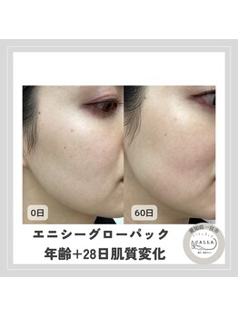 カラー(CALLA)/グローパック肌質変化！