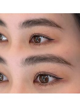 ビー(B)/【ラッシュリフト】