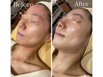 ユウ 尾張旭店(U)/エンビロンビタミンA