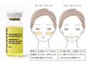 初回★大人気★顔の脂肪を減らしたい★大容量3cc【脂肪分解/レモンボトル】