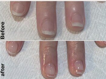 ティヤム(TIAM)/自爪育成ネイル☆