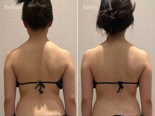 ラシュール(Rassure)/90分で見た目年齢が変わる