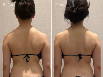 ラシュール(Rassure)/90分で見た目年齢が変わる