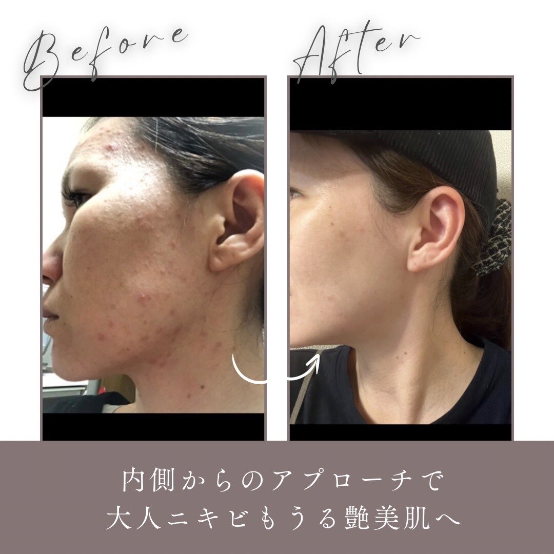 ヨサパーク ル フェルナ(YOSA PARK Le Ferna)｜ホットペッパービューティー