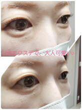 アイクル 伊勢崎店(ikuru)/一重さんもぱっちり♪