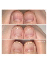 リモネイル(Rimo nail)/爪育成、美爪育成