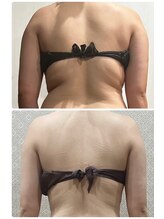 ミーラブ 鹿児島(miilove)/とことん上半身痩せ