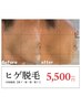 【エステデビュー人気No.1！】ヒゲ脱毛　¥5,500