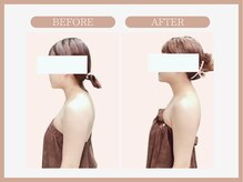 スリムライン 秋田店(The Slim Line)/before→after