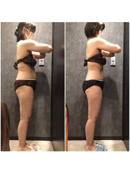 フローボディ 新山口店(flow BODY)/山口のエステはflow BODY