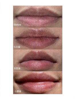 ファースト(1st)/ローマピンク【唇・リップ】