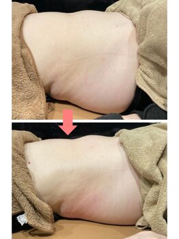 サロンド美美(Salon de vivi)/人気の腸もみ【腸マッサージ】