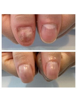 リーフ(Leaf)の写真/遠方からも多数ご来店のある自爪育成専門店。爪噛み癖の克服や剥離のお悩みもお任せください♪