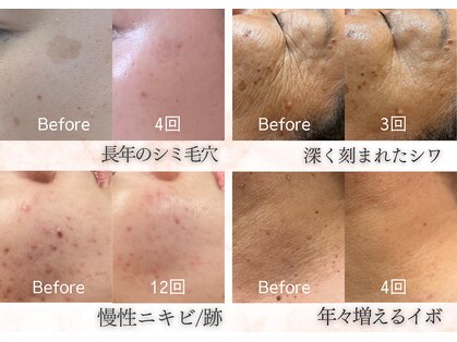 ハナ チュチュ(Hana chuchu)の写真