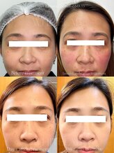 デピラード(Depilado)/