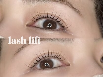 エース(ace)の写真