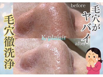 ケイ プレジール/【北浜】念入に毛穴洗浄致します