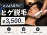 【メンズ人気No.1】ヒゲ脱毛 ¥3500