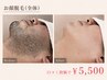 【男性口コミ限定】顔脱毛 ¥5,500