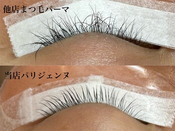 ジーナ(Gina)/他店と当店施術比較