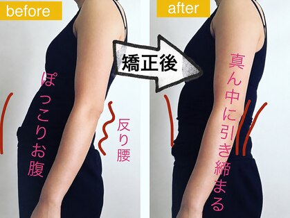 ミモザ(mimosa)の写真