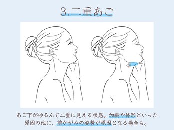 シーズ ラボ 北千住店/二重あご