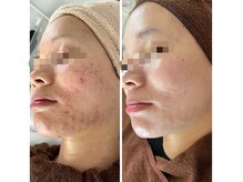 確かな技術でお客様がキレイになるお手伝いをさせていただきます